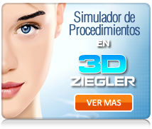 Simulador 3D de cirugía Crisalix