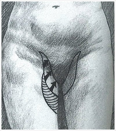 Gráfico: Lifting de Muslos Internos