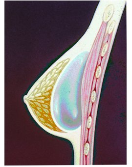 Posición Subglandular