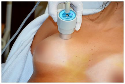 Tratamiento Ultrasonido Externo