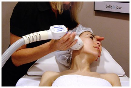 Tratamiento Velasmooth Facial